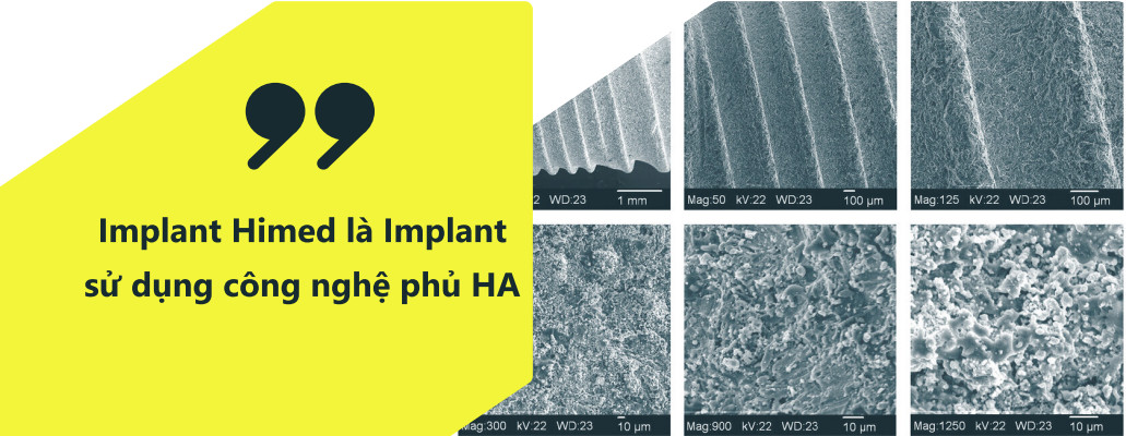 HIMED HA IMPLANT - 30 NĂM LỊCH SỬ NGHIÊN CỨU VÀ CHẾ TẠO